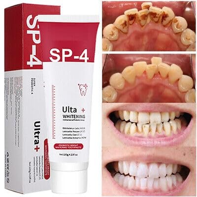 GIONAR Probiotic Whitening Toothpaste – Natural Brightening, Stain Removal & Fresh Breath Care